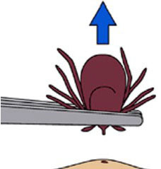 A1Exterminators Why Fall Ticks Are the Most Dangerous 3 A1Exterminators removal ab